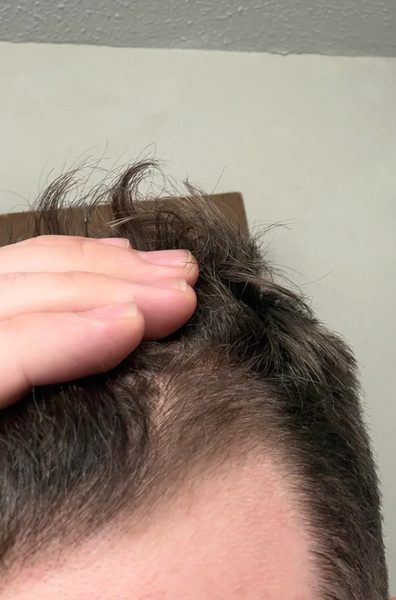After Image