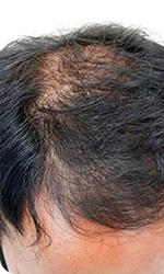 Before Image