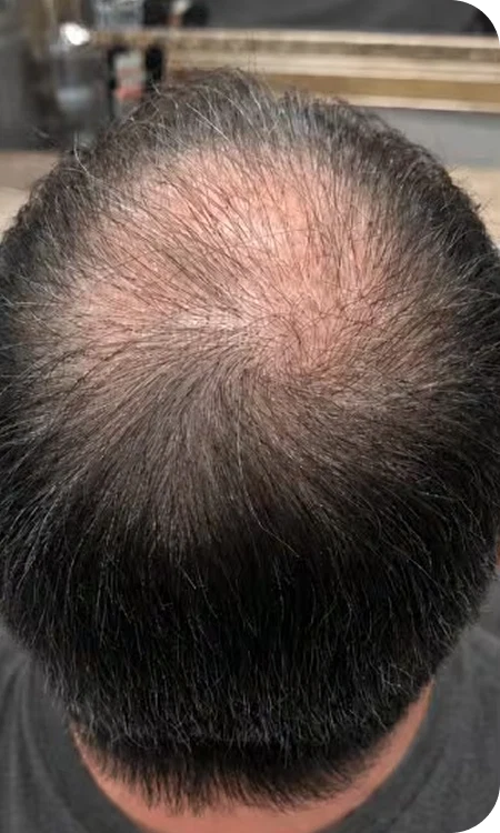 After Image