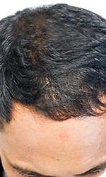 After Image