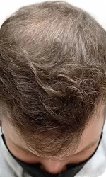 After Image
